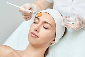 glyco peel facial irvine